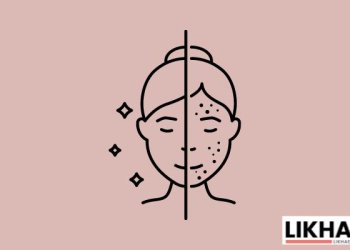 Skin Issues in Females