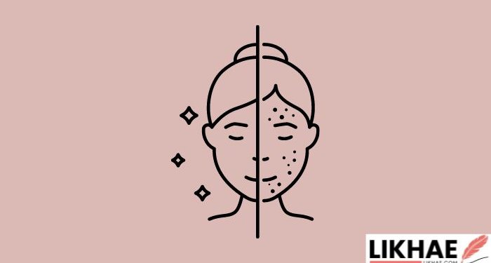 Skin Issues in Females
